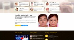 Thiết kế Website - Theme Wordpress Dịch Vụ Spa, Mỹ Phẩm, Thẩm Mỹ, Y Tế Sức Khỏe 01